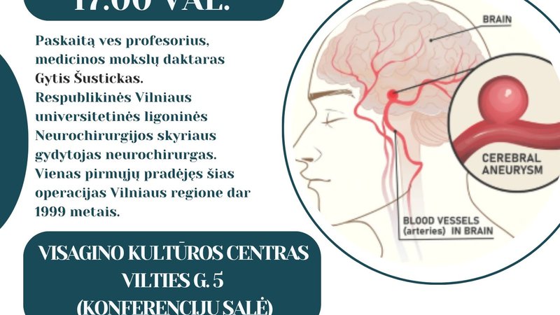 Smegenų aneurizma: kaip nepraleisti pavojaus – profesoriaus paskaita Visagine - Reklama